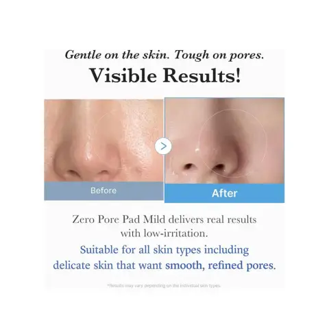 Medicube Zero Pore Pad Mild 155g thumbnail 3