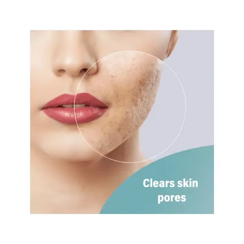 A-Ret Cream 30g thumbnail 2