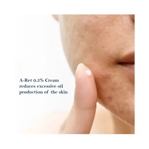 A-Ret Cream 30g thumbnail 4