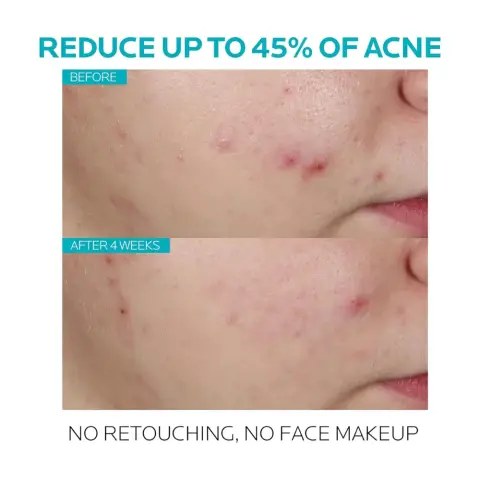 Laroche Posay Effaclar Serum 30mL thumbnail 2