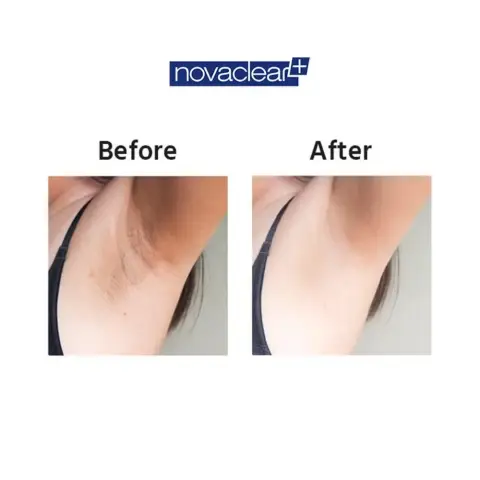 Novaclear Whitening Brightening Underarm Roll-On 50mL thumbnail 3