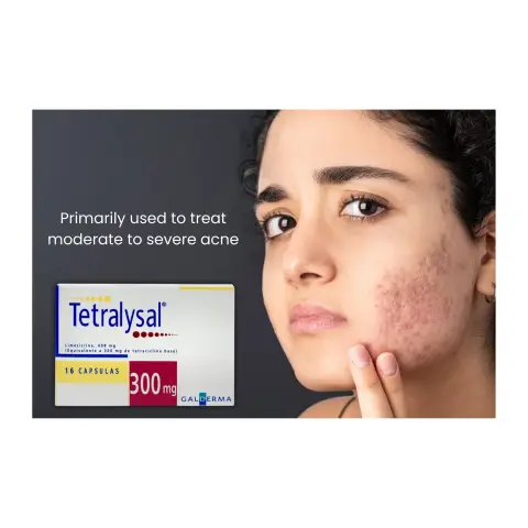 Tetralysal 300mg Capsules 16s thumbnail 2