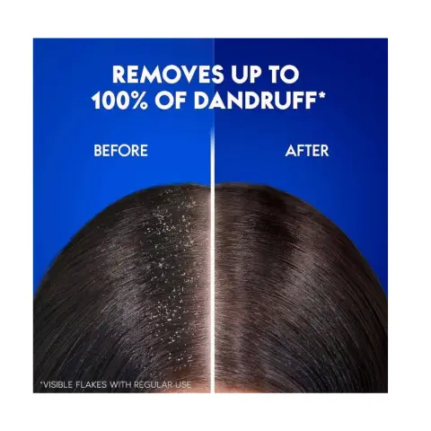 Head & Shoulder Charcoal Detox Shampoo 400mL thumbnail 2