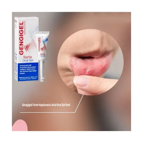 Gengigel Forte Oral Gel 8ml thumbnail 2