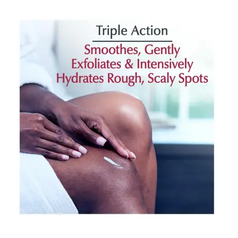Eucerin Roughness Relief Smoothing Spot Cream for Keratosis Pilaris 71g thumbnail 2