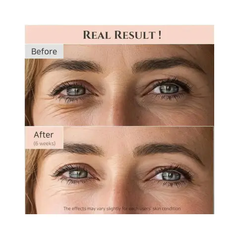 Beauty of Joseon Revive Eye Serum with Ginseng & Retinal 30ml thumbnail 3