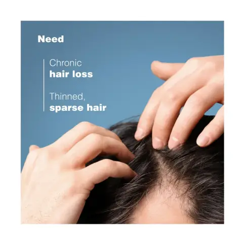 Ducray Neoptide Expert Anti Hair Loss & Growth Serum 2X50 mL thumbnail 4