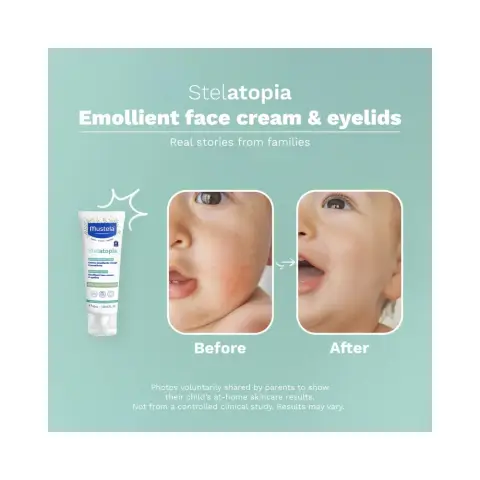 Mustela Stelatopia Emollient Face Cream 40 Ml thumbnail 2