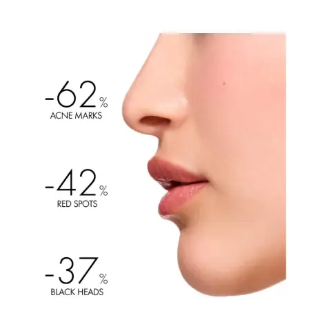 Vichy Normaderm Phytosolution Double Correction Daily Care Moisturiser for Oily & Acne Skin with Salicylic Acid 50ml thumbnail 2