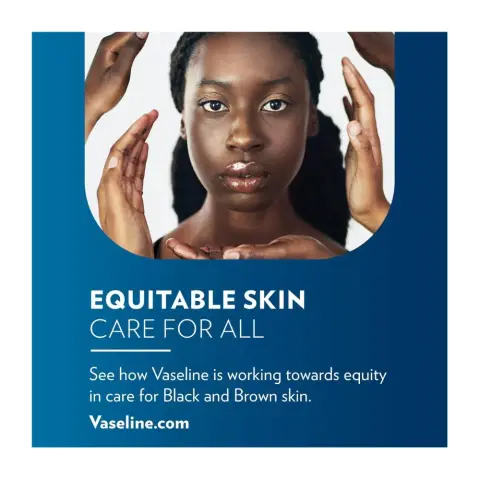 Vaseline Lip Therapy Original 20G thumbnail 4